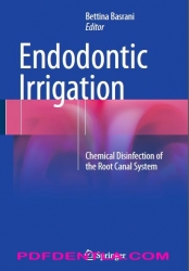 Endodontic Irrigation Chemical disinfection of the root canal system (pdf)
